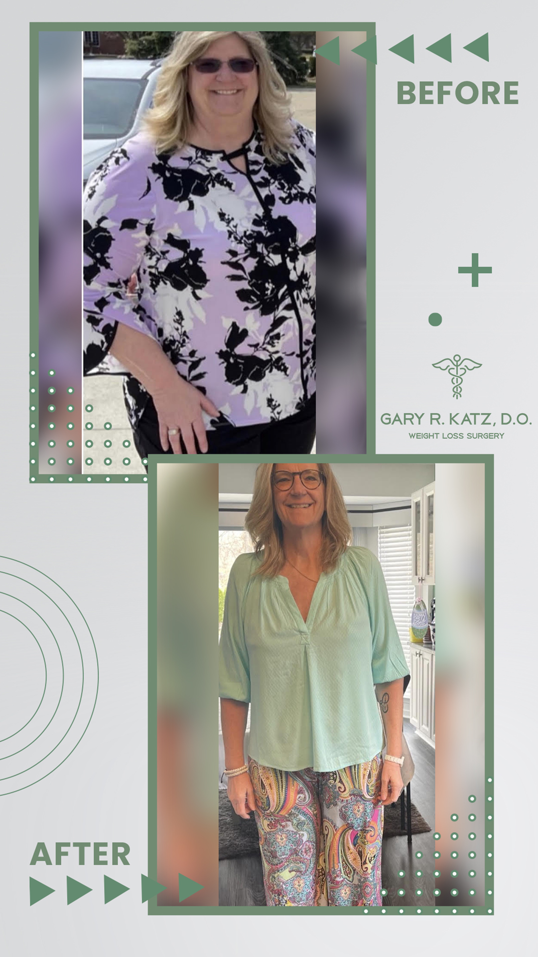Dr. Gary Katz Weight Loss Surgery Transformation Success Story